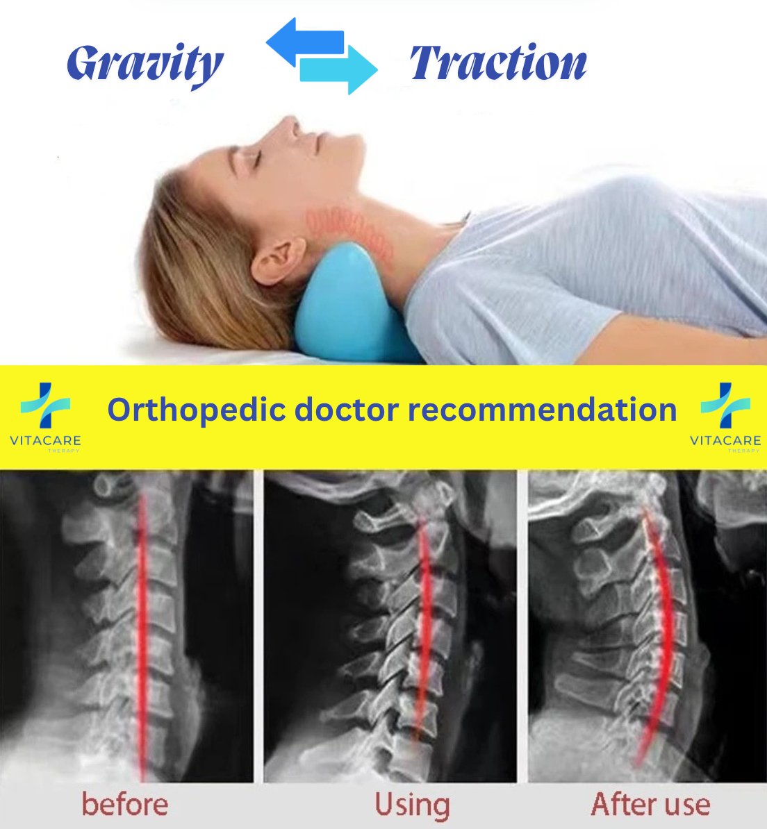 SpineAlign™ Neck Relaxer